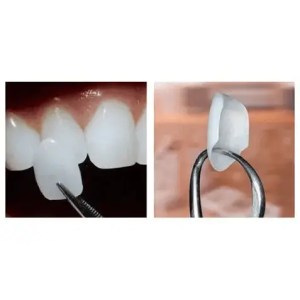 mejor dentista en miami, carillas de porcelana en miami, Botox miami, costo del tratamiento de conducto en miami, elevación de seno nasal en miami, mejores carillas en miami, mejor dentista del sur de florida, mejor dentista cosmético en miami, mejor atención dental en miami, sage dental